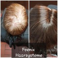 Haarintgration, Echthaar, Hairweaving Befestigung